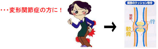�O���R�T�~���@�I��G�A��E���E���E�Ҋ֐߂̒ɂ݁A�ό`�֐ߏǂ�